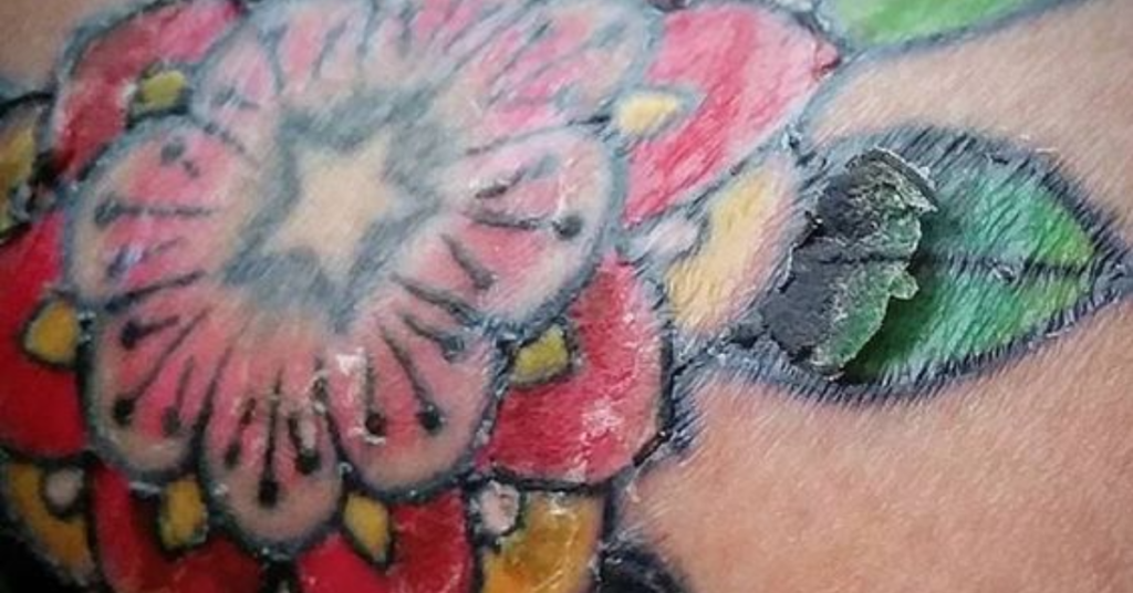 How To Prevent Scabbing On A New Tattoo