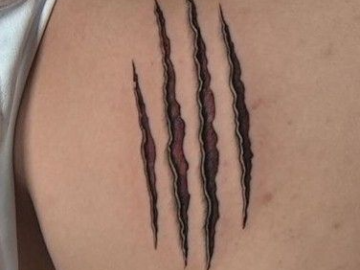 Infected Tattoo: Signs of an Infection and Treatment Options